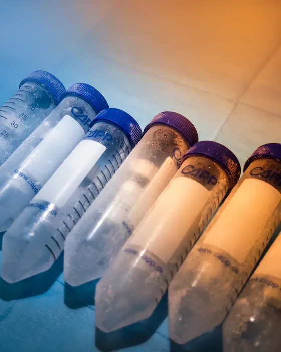 Exosome therapy